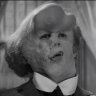 Elephant_man